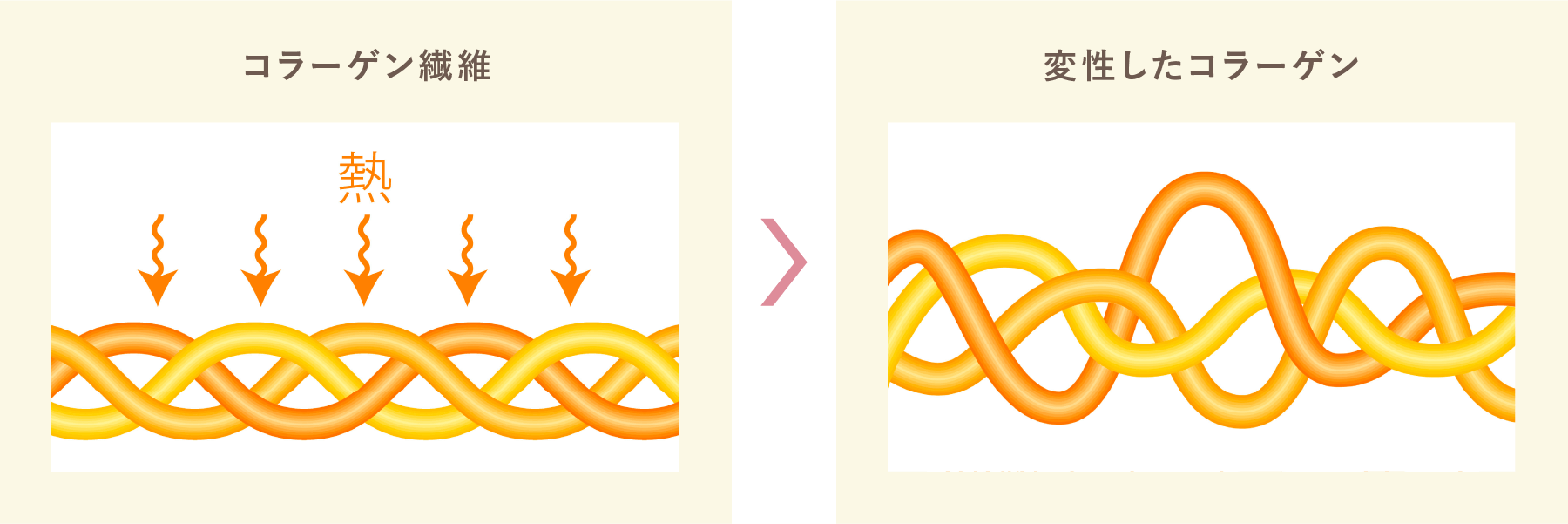 コラーゲン繊維と変性したコラーゲンのイメージ図